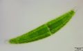 Closterium sp.